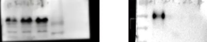 Western Blot（WB）实验科研小白系列-上