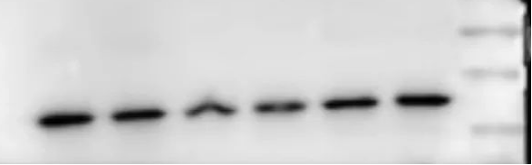 Western Blot（WB）实验科研小白系列-上