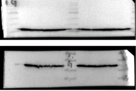Western Blot（WB）实验科研小白系列-上