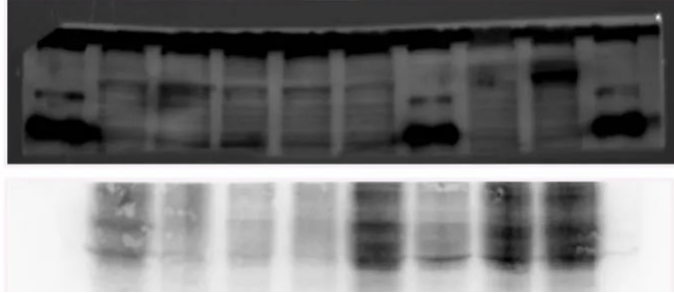 Western Blot（WB）实验科研小白系列-上