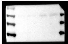 Western Blot（WB）实验科研小白系列-上