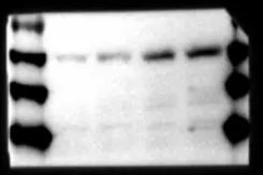 Western Blot（WB）实验科研小白系列-上
