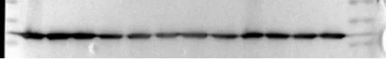Western Blot（WB）实验科研小白系列-上