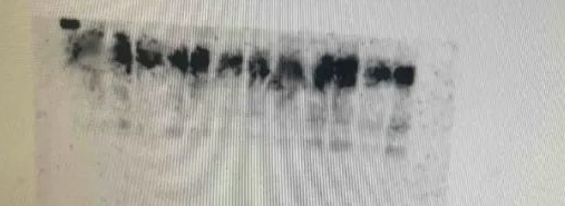 Western Blot（WB）实验科研小白系列-上